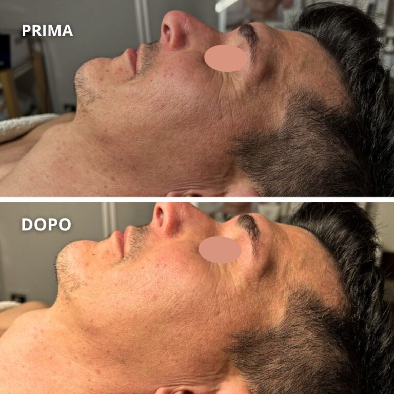 Pelle-del-VISO-perfetta-con-Viso-da-STAR-6.jpg